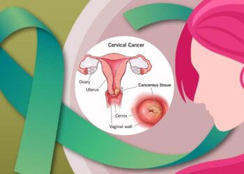 Cervical Cancer