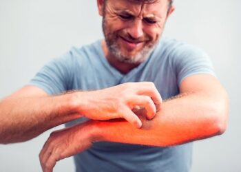 HEALTH : ‘Fungal Infection’ ची कारणे काय? कशी घ्यावी काळजी आणि उपाय, वाचा हि माहिती