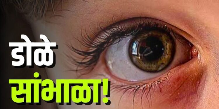 Myopia : मुलांना जास्त फोन वापरू देत असाल तर हि बातमी वाचाचं ! मुलांमध्ये आढळतोय Myopia, काय आहेत लक्षणे ? वाचा सविस्तर