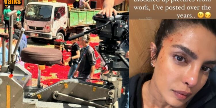 Priyanka Chopra : ग्लोबल स्टार प्रियंका चोप्राचा अमेरिकेत अपघात; हेड्स ऑफ स्टेटच्या शूटिंग दरम्यान दुखापत